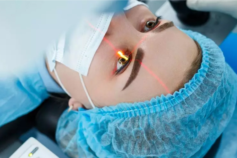 cirugia lasik porque importa