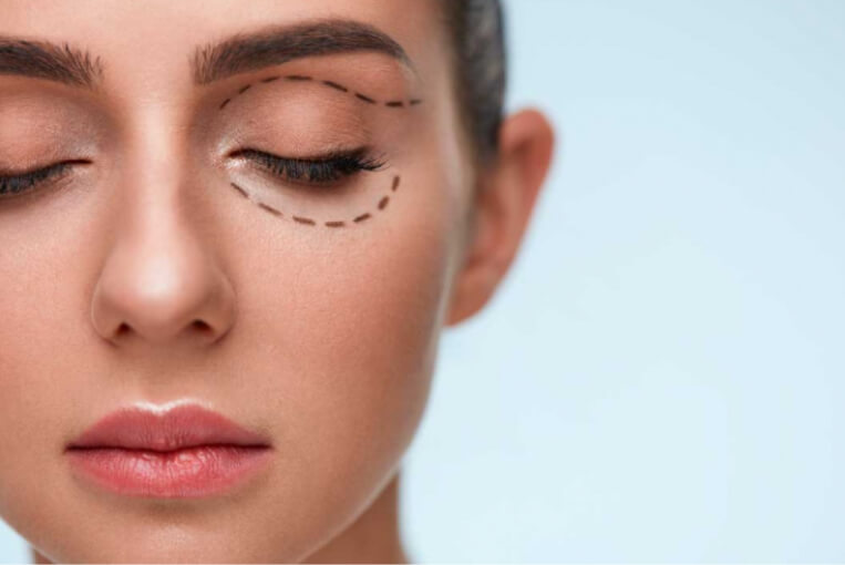 Cirugía plástica ocular