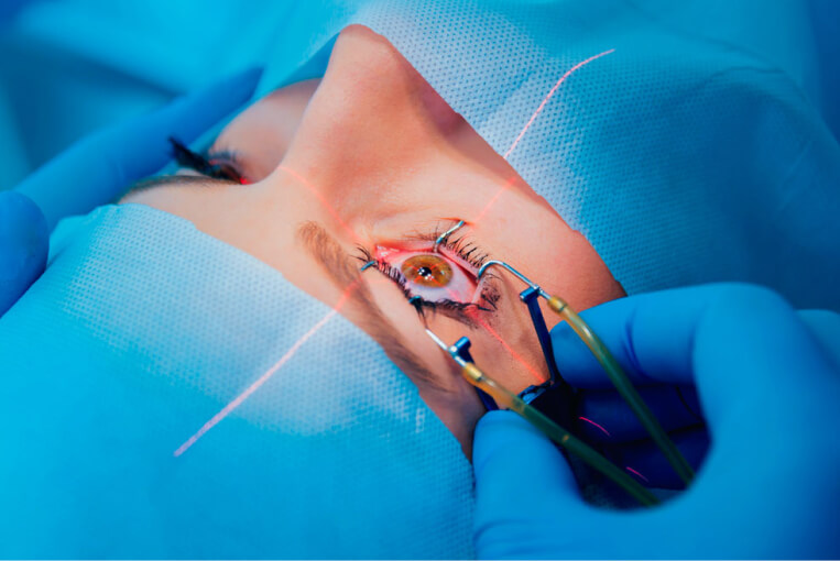 cirugia lasik o prk